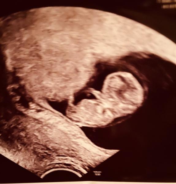 Bild zu Mutmach-Post - Forum für September - Mamis