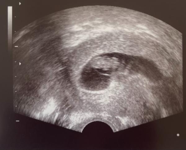Bild zu Gute Neuigkeiten! - Forum für September - Mamis