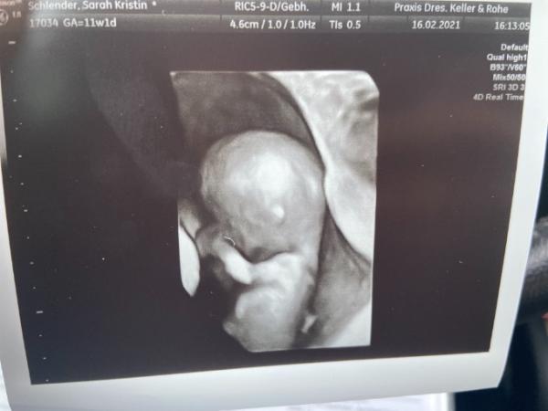 Bild zu Fa Termin - Forum für September - Mamis