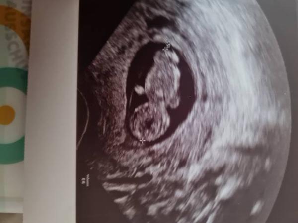 Bild zu Ich habe es auch geschafft - Forum für September - Mamis
