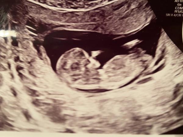 Bild zu Einfach nur glücklich! - Forum für September - Mamis