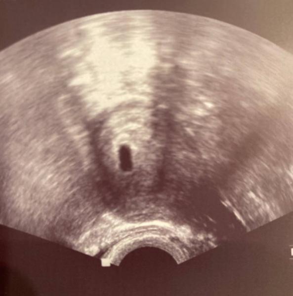 Bild zu Schwangerschaft - Forum für September - Mamis