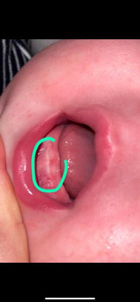 Bild zu Weiß jemand was das ist ? - Forum für September - Mamis