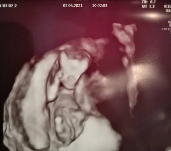 Bild zu Zurück vom FA - Forum für September - Mamis
