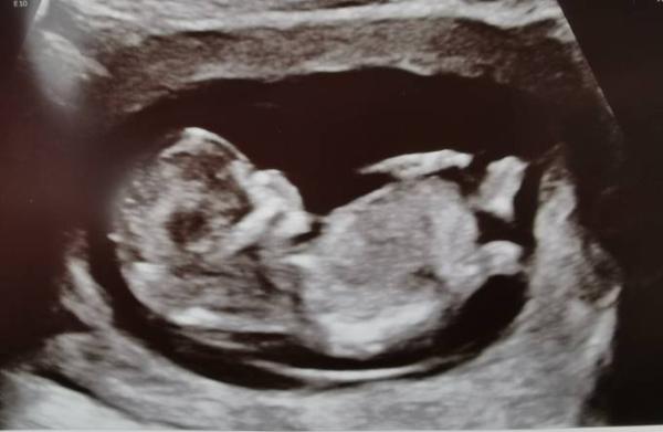 Bild zu Bin auch noch da :) - Forum für September - Mamis