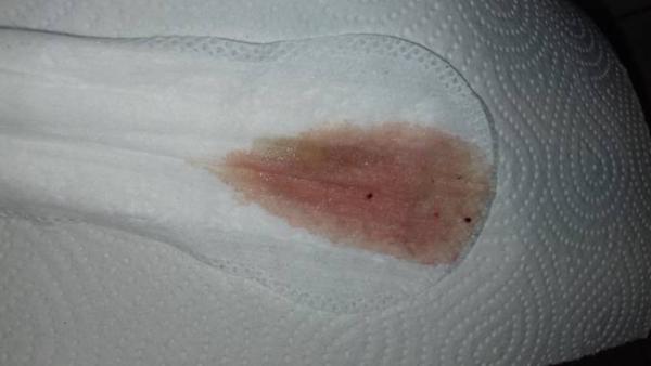 Bild zu rosa ausfluss Achtung BILD - Forum für September - Mamis