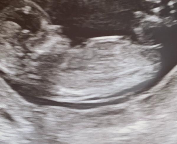 Bild zu Mädchen oder Junge? - Forum für September - Mamis