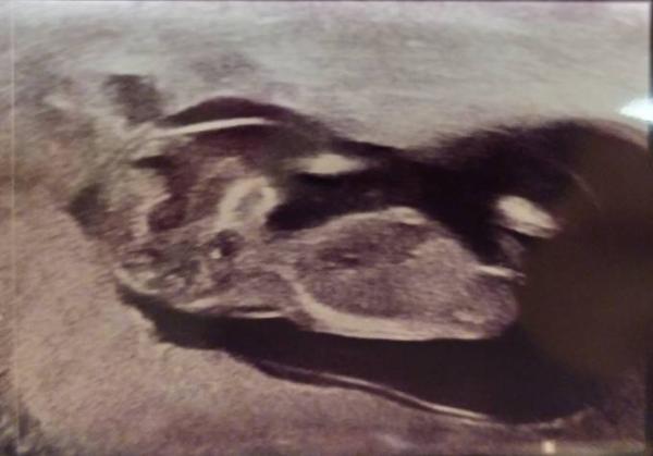 Bild zu Nun erkennbar? - Forum für September - Mamis