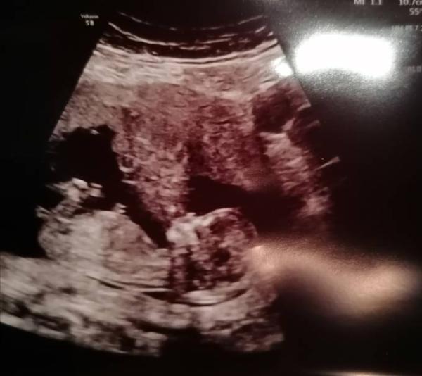 Bild zu Geschlecht? NUB Theorie? - Forum für September - Mamis