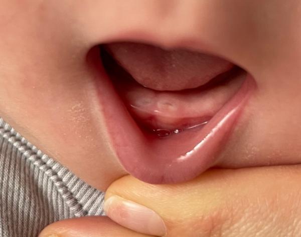 Bild zu Da sind sie ! :O - Forum für September - Mamis