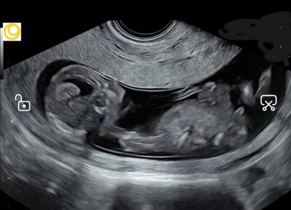 Bild zu Der Anruf kam - Forum für September - Mamis
