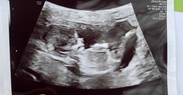 Bild zu Was meint ihr? - Forum für September - Mamis