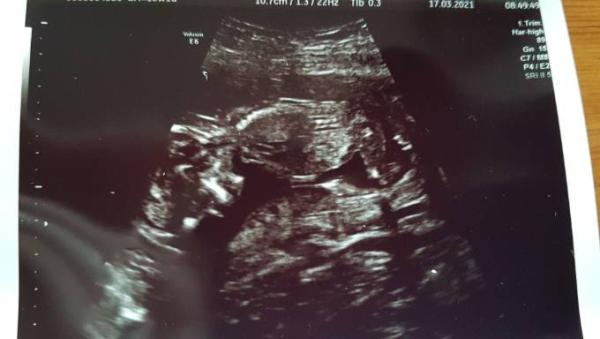 Bild zu 2. Termin erfolgt - Forum für September - Mamis