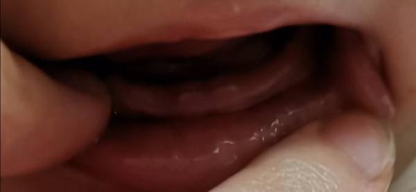 Bild zu Zähne 😍 - Forum für September - Mamis