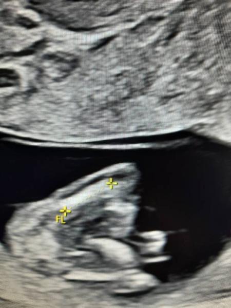 Bild zu So neugierig... - Forum für September - Mamis
