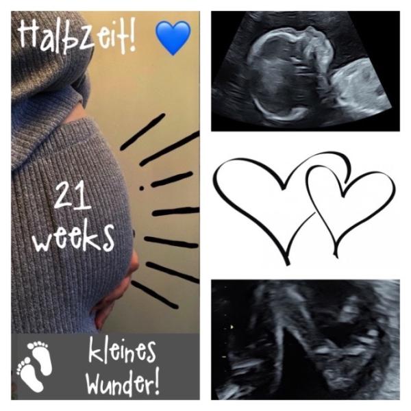Bild zu Gestern Halbzeit & großer Ultraschall 💙 - Forum für September - Mamis