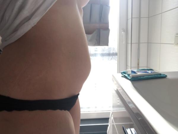 Bild zu Vorderwandplazenta - Forum für September - Mamis