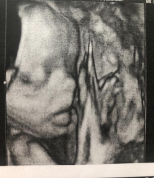 Bild zu Organscreening check :) - Forum für September - Mamis