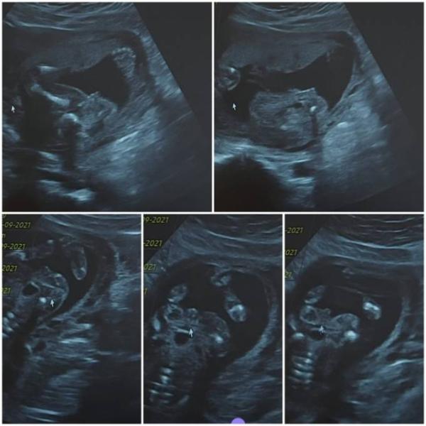 Bild zu Junge oder Mädchen - Forum für September - Mamis