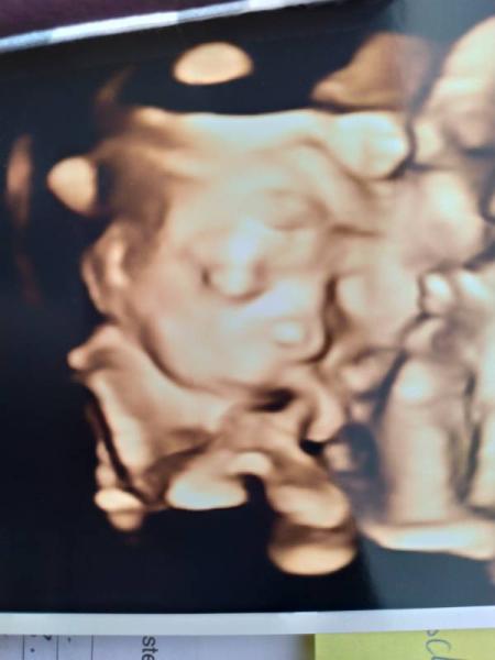 Bild zu Organscreening der Regenbogenprinzessin - Forum für September - Mamis