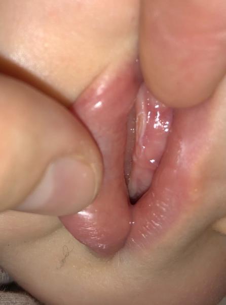 Bild zu Zähnchen - Forum für September - Mamis