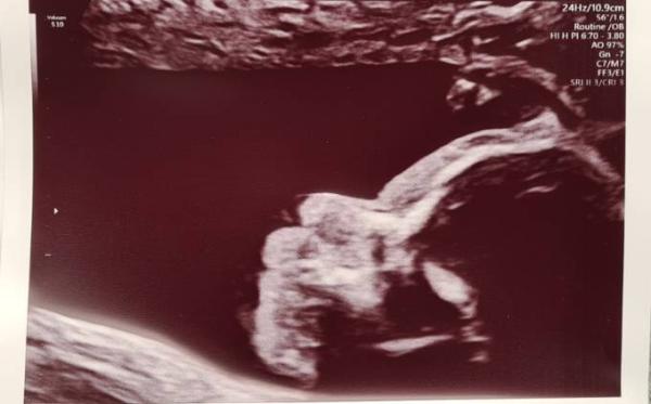 Bild zu Endlich wieder Termin - Forum für September - Mamis