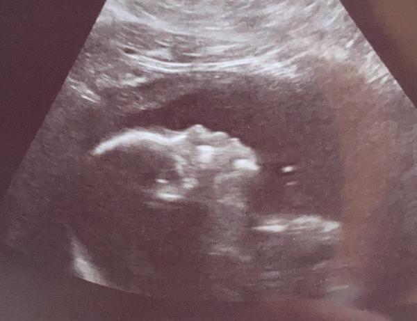 Bild zu So verliebt - Forum für September - Mamis