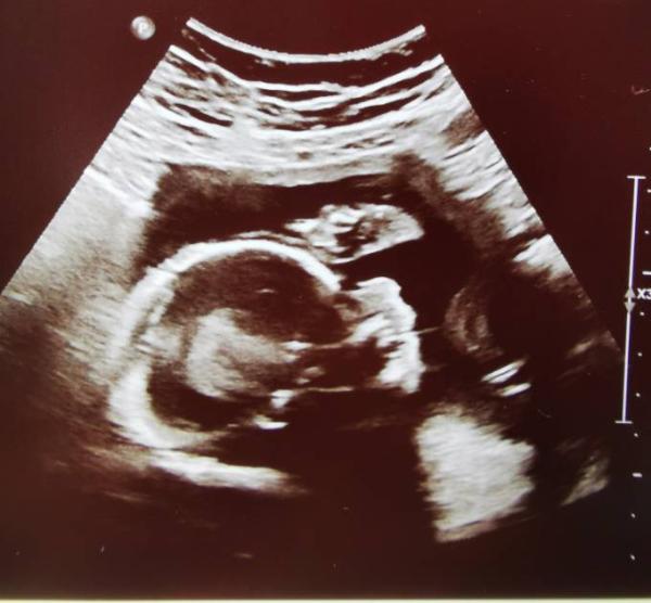 Bild zu Wie geht's euch? - Forum für September - Mamis