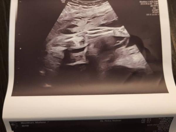 Bild zu Ein hin und her.... - Forum für September - Mamis