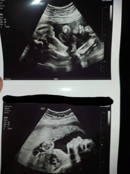 Bild zu Endlich Outing 25+4 SSW - Forum für September - Mamis