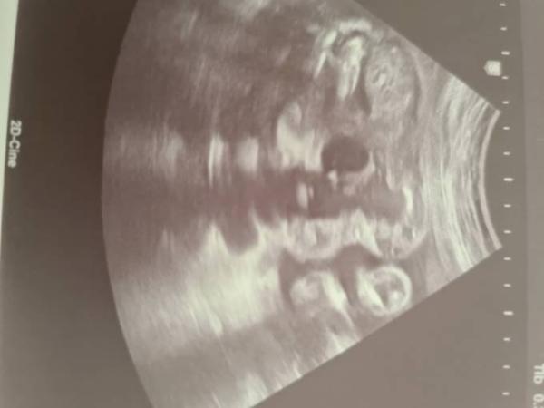 Bild zu Geschlecht Erkennen!! - Forum für September - Mamis