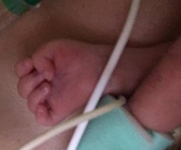 Bild zu Ausgekugelt am 15.7 - Forum für September - Mamis