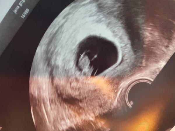 Bild zu Alle guten Dinge sind 3.. - Forum für September - Mamis