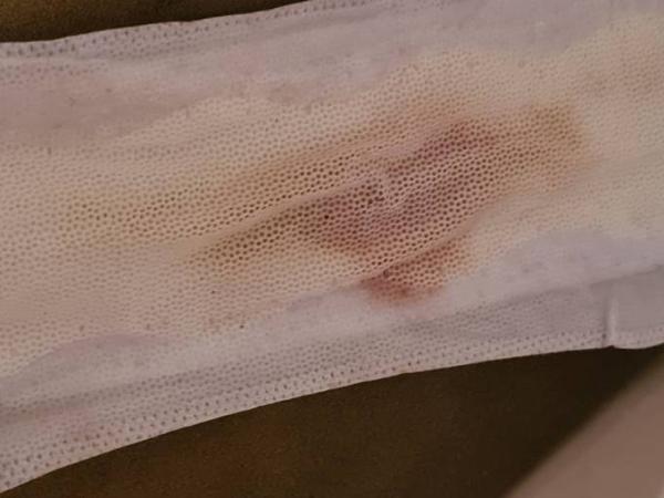 Bild zu Bitte hilft mir (Achtung Bild)!! - Forum für September - Mamis