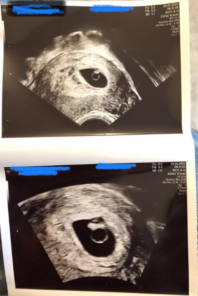 Bild zu Das Herzchen schlägt (6+3) - Forum für September - Mamis