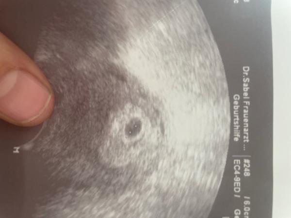 Bild zu Zwillinge ? - Forum für September - Mamis