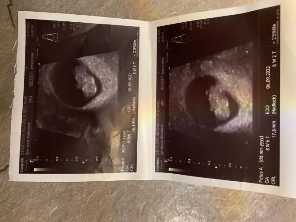 Bild zu 2. Ultraschall - Forum für September - Mamis
