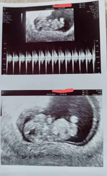 Bild zu Wie geht es euren Baby's? - Forum für September - Mamis