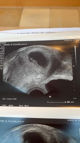Bild zu Ultraschall - erstmal mega glücklich! - Forum für September - Mamis