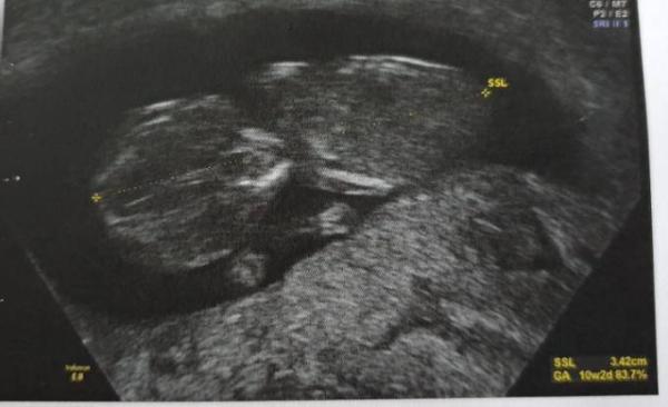 Bild zu Pure Freude 😊🍀 - Forum für September - Mamis