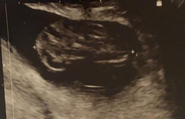 Bild zu Verliebt und erleichtert - Forum für September - Mamis