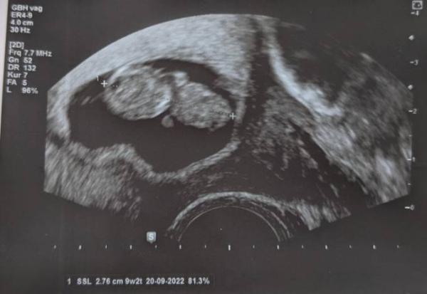 Bild zu Alles gut! - Forum für September - Mamis
