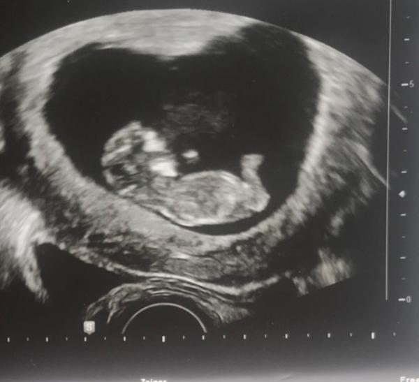 Bild zu Geschlechtserkennung eventuell? - Forum für September - Mamis