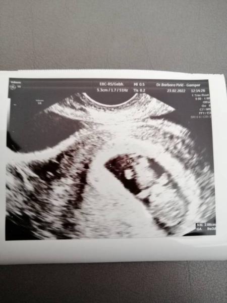 Bild zu Zweiter Ultraschall nach Corona - Forum für September - Mamis