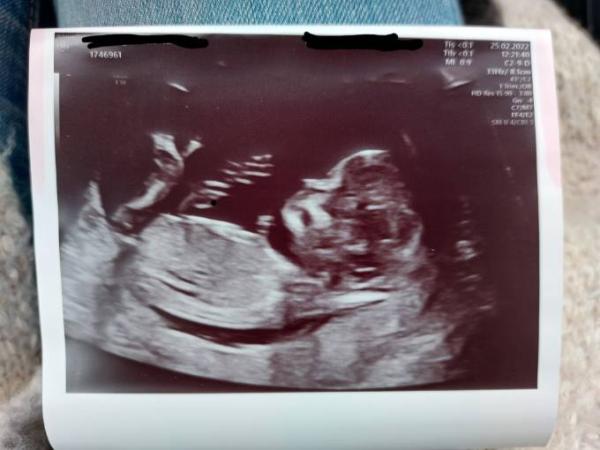 Bild zu Gibt es schon erste Geschlechtervermutungen? 🥰 - Forum für September - Mamis