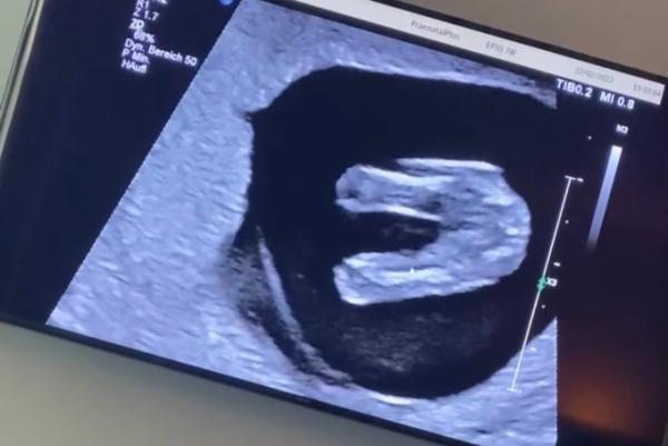 Bild zu Was meint ihr? 💙 Oder 💗 - Forum für September - Mamis