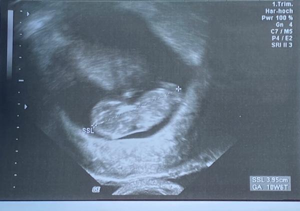 Bild zu Kontrollultraschall. Glücklich! - Forum für September - Mamis