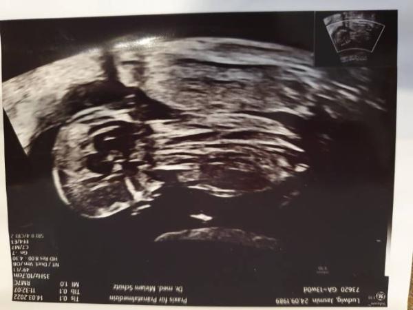 Bild zu Was meint ihr? 💙oder💖 - Forum für September - Mamis