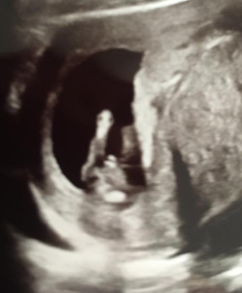 Bild zu Geschlechtstendenz 🧡 - Forum für September - Mamis