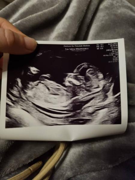 Bild zu Junge oder Mädchen - Forum für September - Mamis